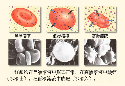红细胞在不同渗透压溶液中的形态